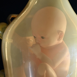 Death Stranding, BB Pod